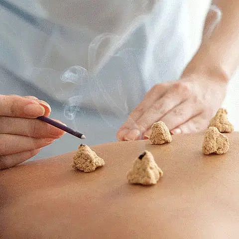 Ai Jiu ( Tütsü ) Terapi