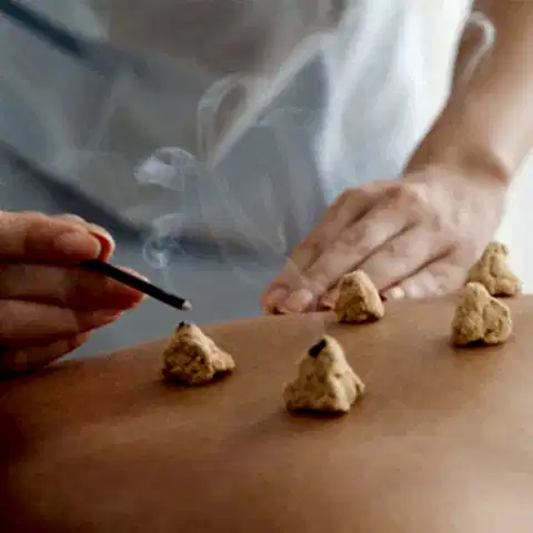 Ai Jiu ( Tütsü ) Terapi