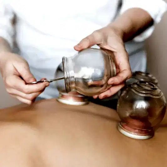 Baguan ( Ateşli Kupa ) Terapi